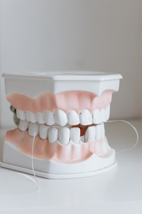 Modelo odontológico usado para explicar tratamentos ao paciente